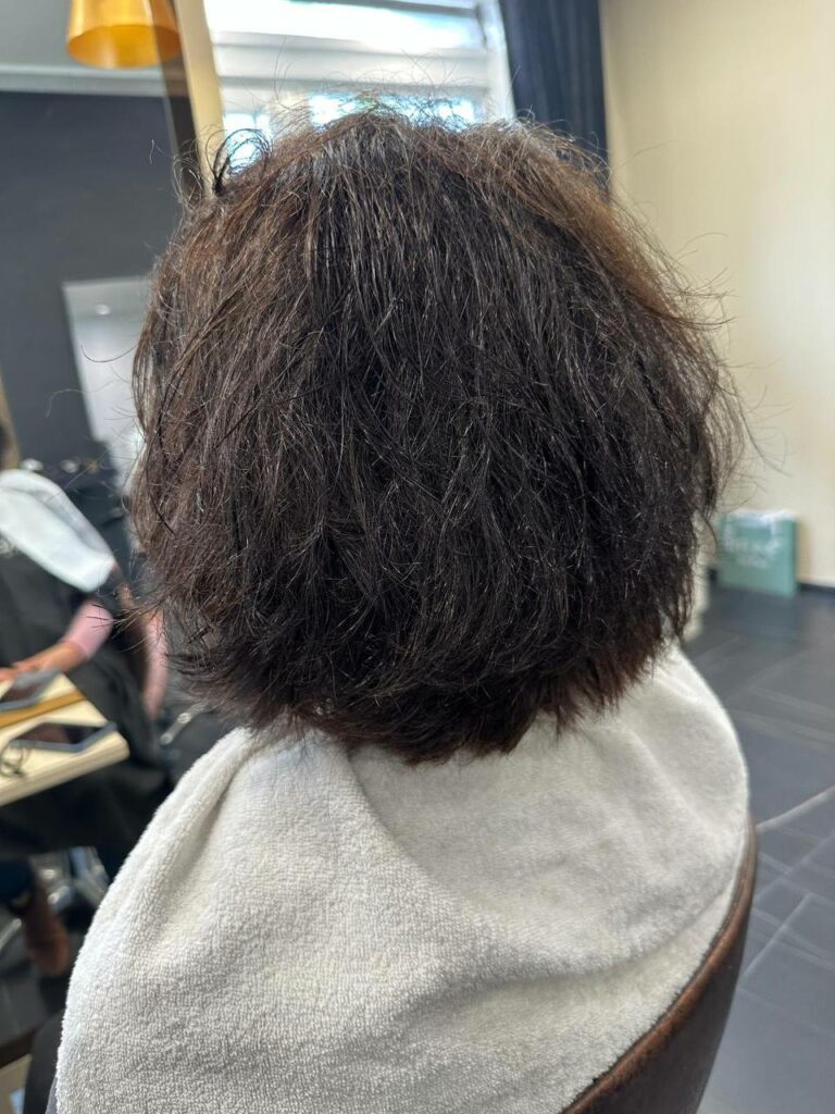 soin botox casa mana à Toulouse